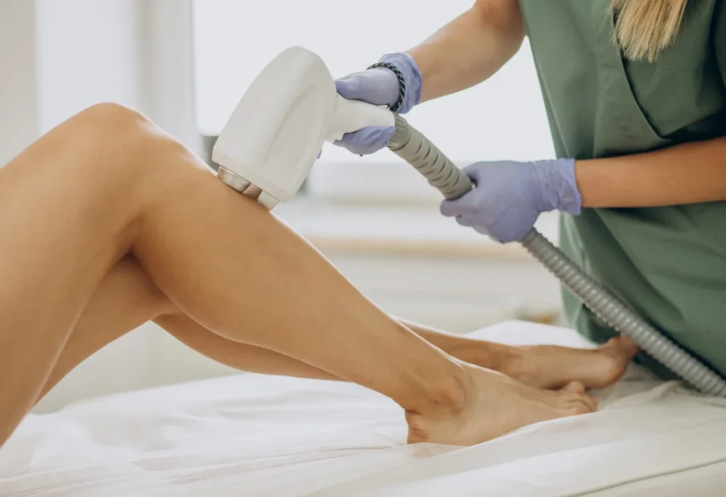 épilation par laser