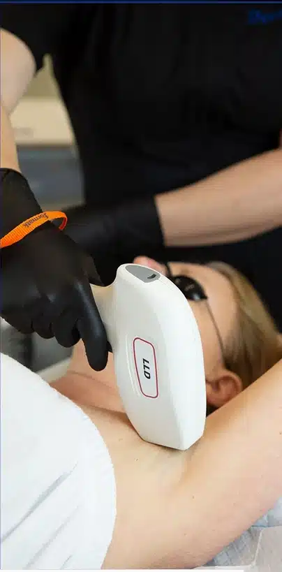 épilation laser depilor