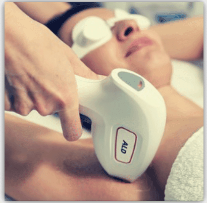 epilation laser depilor