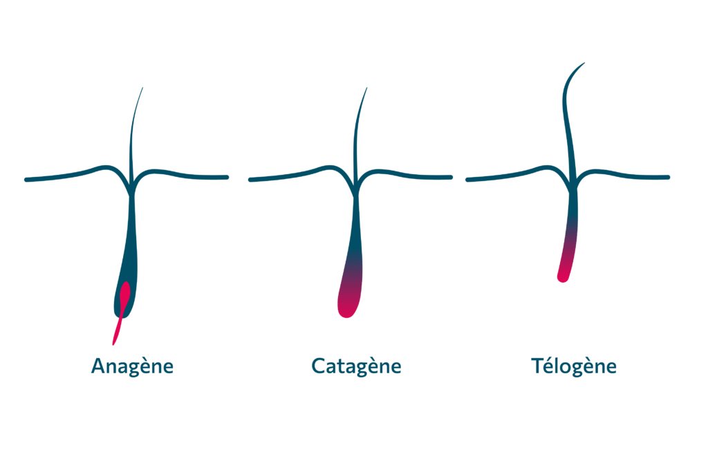 Schéma du fonctionnement de l'épilation laser