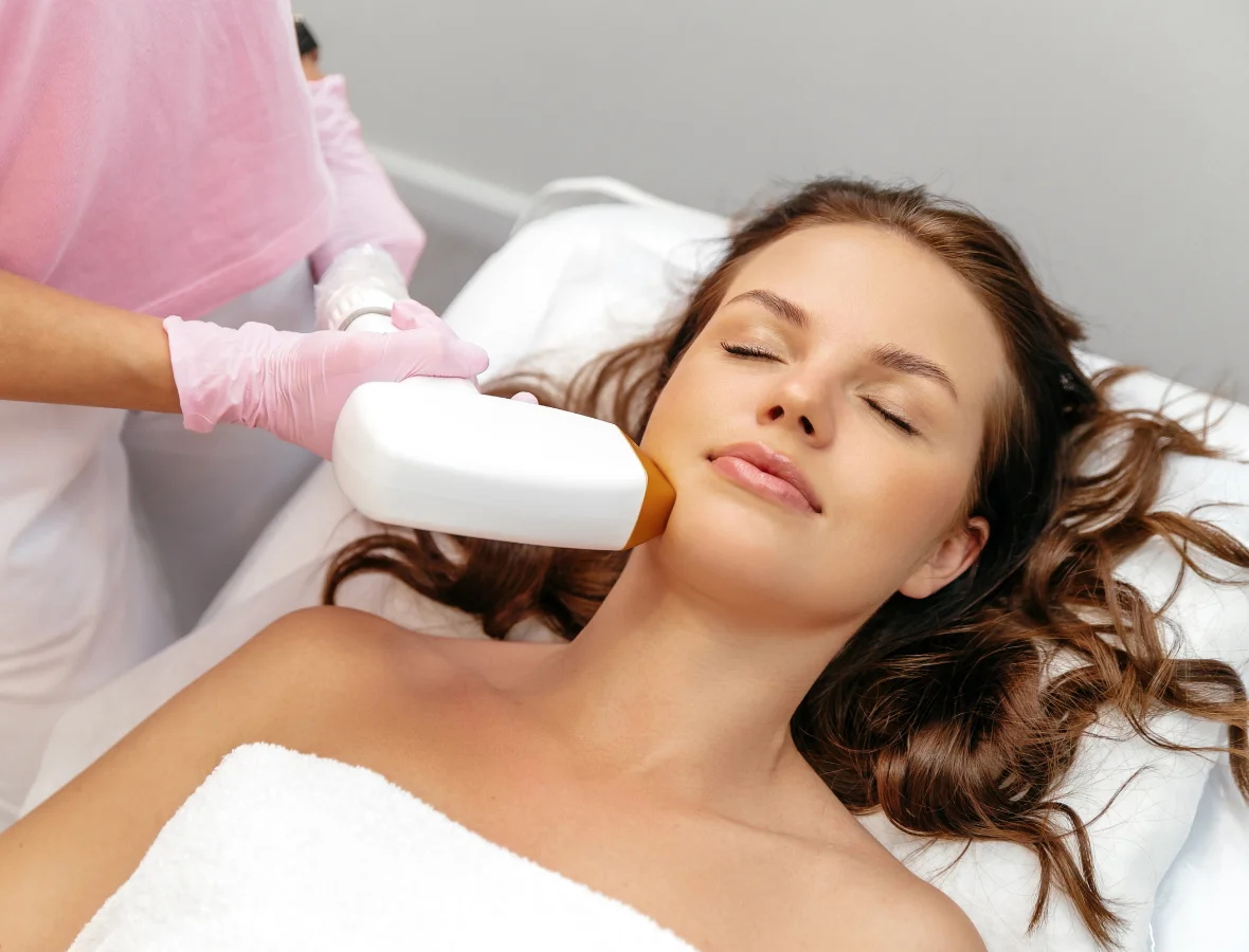 Épilation laser du visage chez la femme