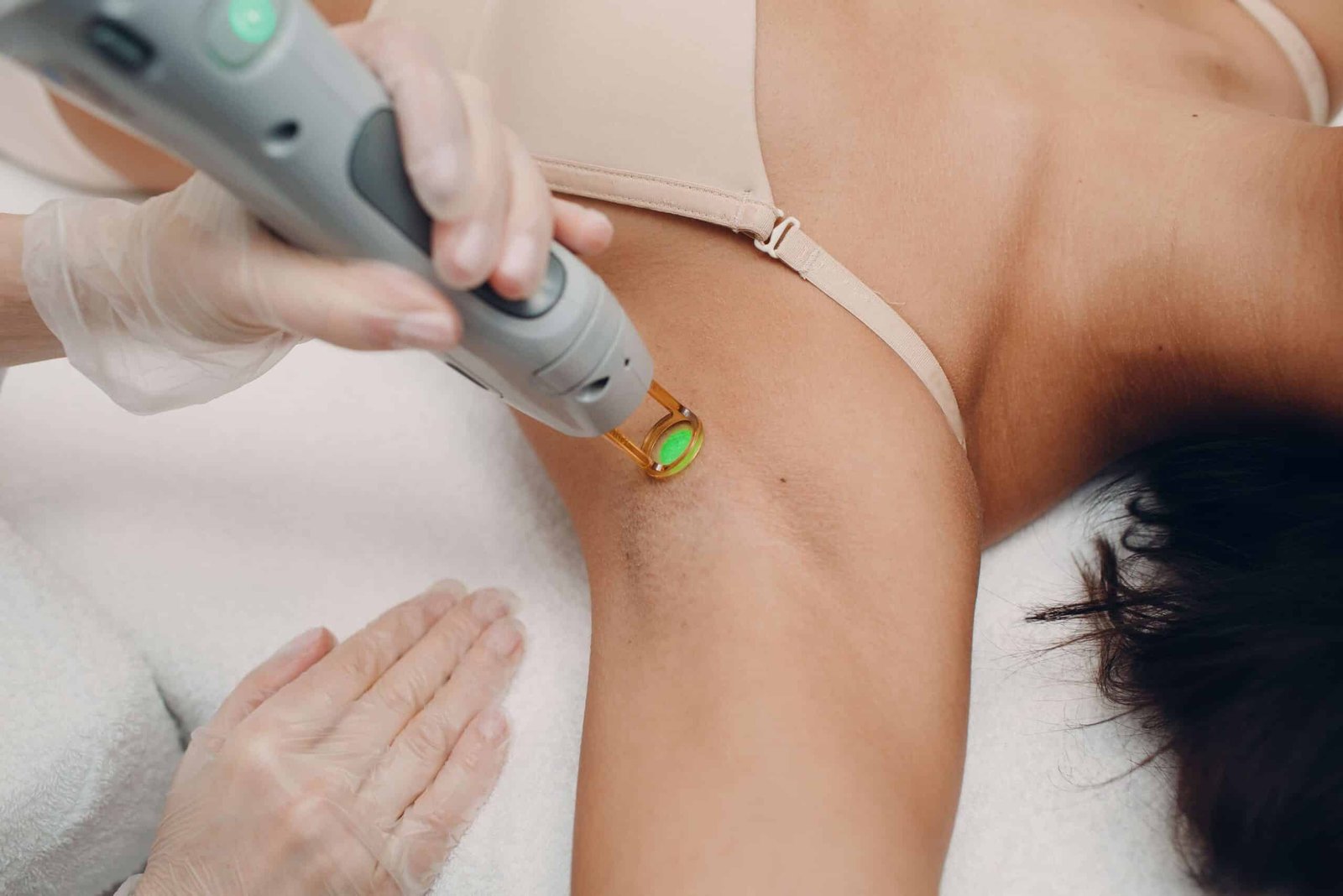 Comment fonctionne l’épilation laser sur le poil