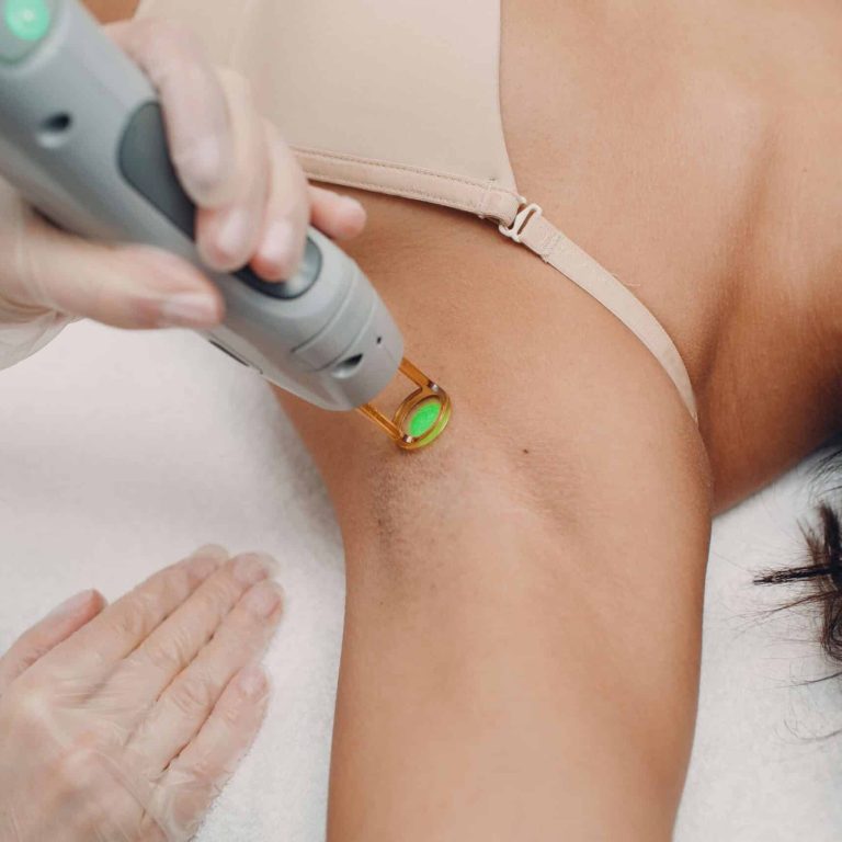 comment-bien-se-preparer-avant-une-epilation-laser-cover-skin-marceau-scaled