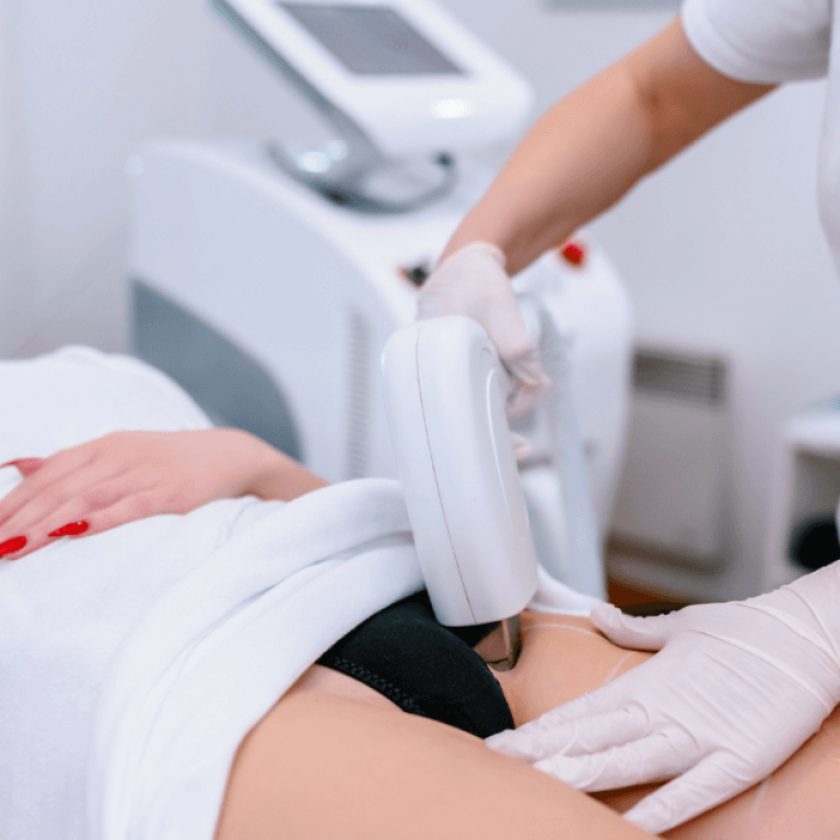 Douleur épilation laser