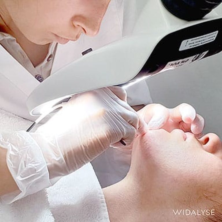 seance_epilation_electrolyse_visage_