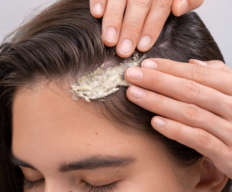 peeling cheveux