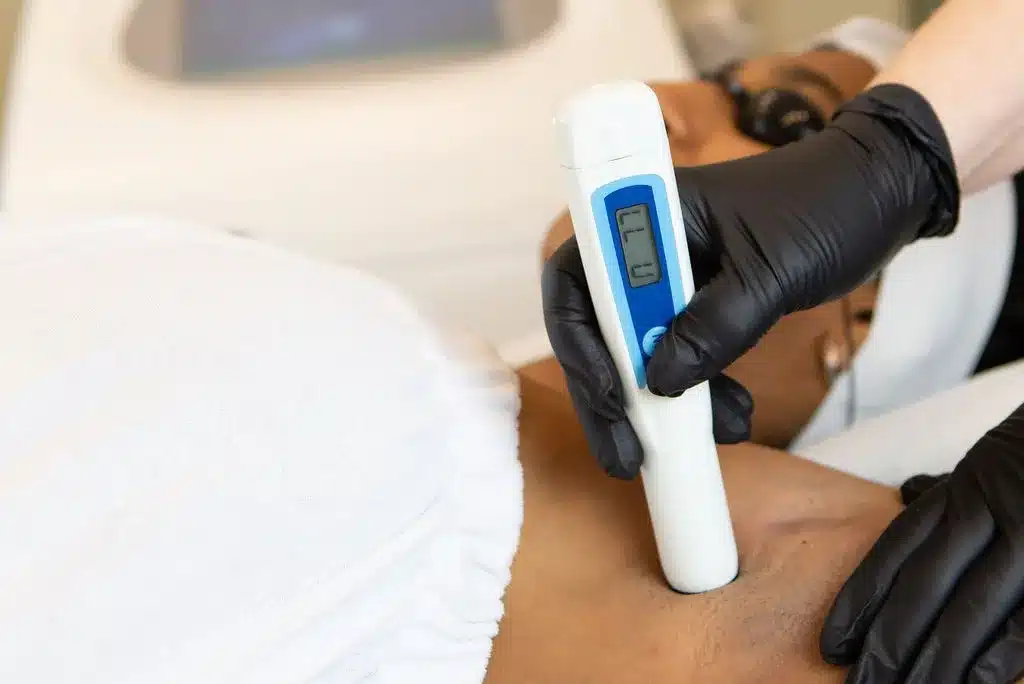 Combien de séances d’épilation laser prévoir ?